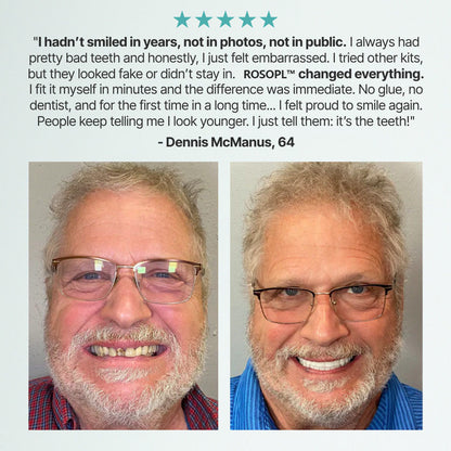Ends Today: 70% OFF!🦷DarkFairy™ Custom-Fit Full Functional Dentures Make you more confident