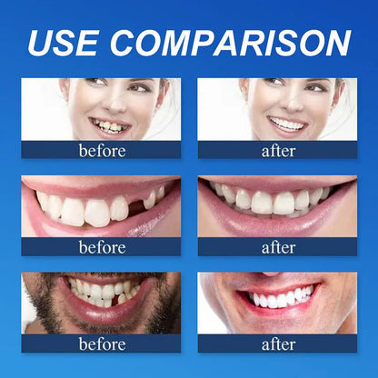 ⏰Ends Today: 75% OFF! 🦷DarkFairy™ Medical Full Denture with Strong Suctiond Custom-Fit Full Functional Dentures🦷