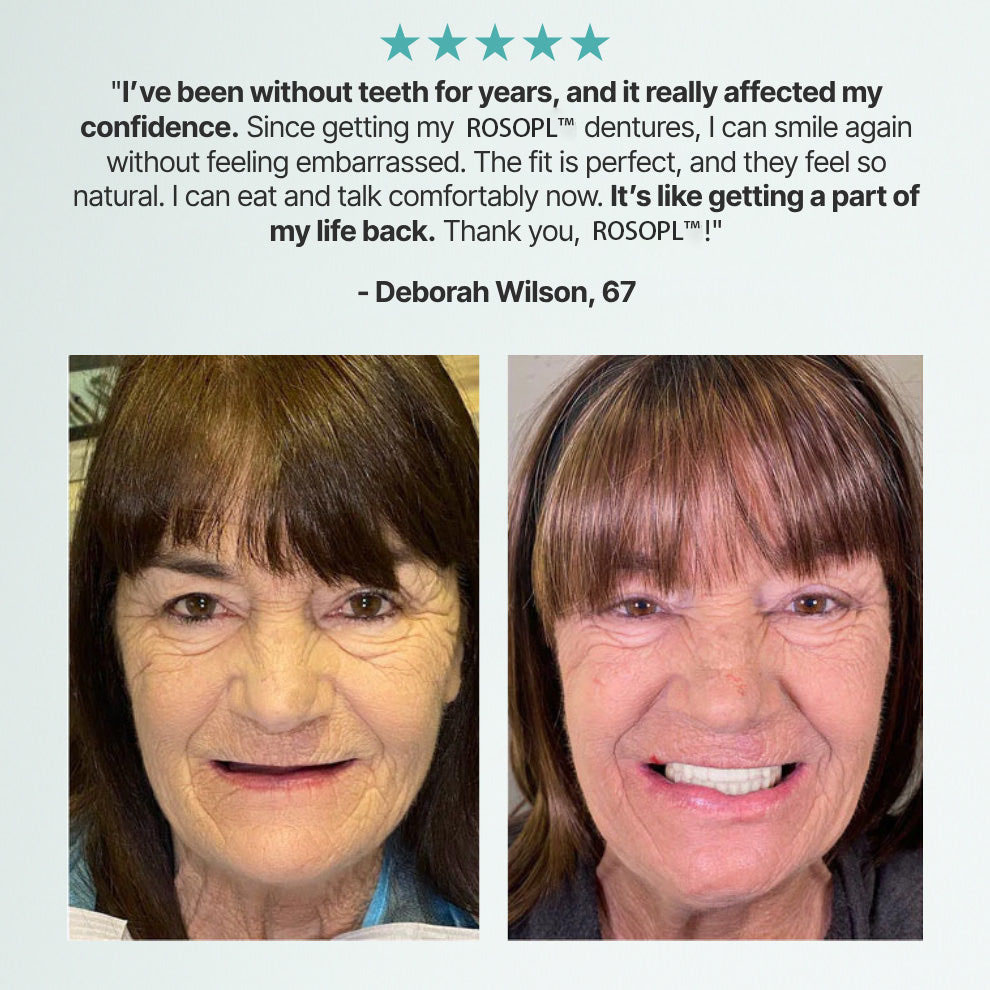 Ends Today: 70% OFF!🦷DarkFairy™ Custom-Fit Full Functional Dentures Make you more confident